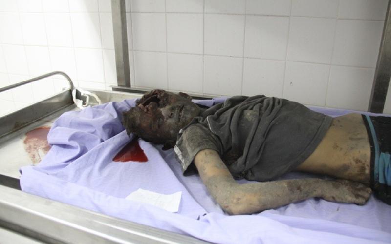 صور: شهداء وجرحى باستهداف منزل عائلة "كوارع"