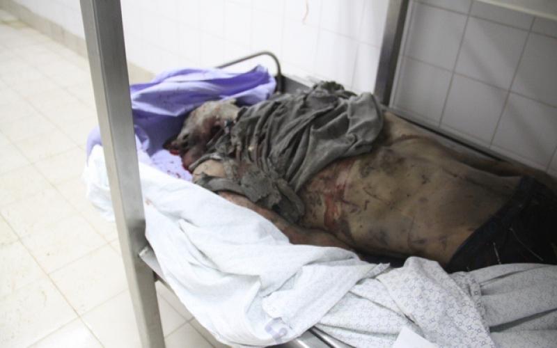 صور: شهداء وجرحى باستهداف منزل عائلة "كوارع"