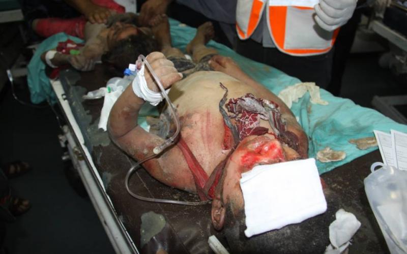 صور: وصول إصابات لمشفى الشفاء بغزة