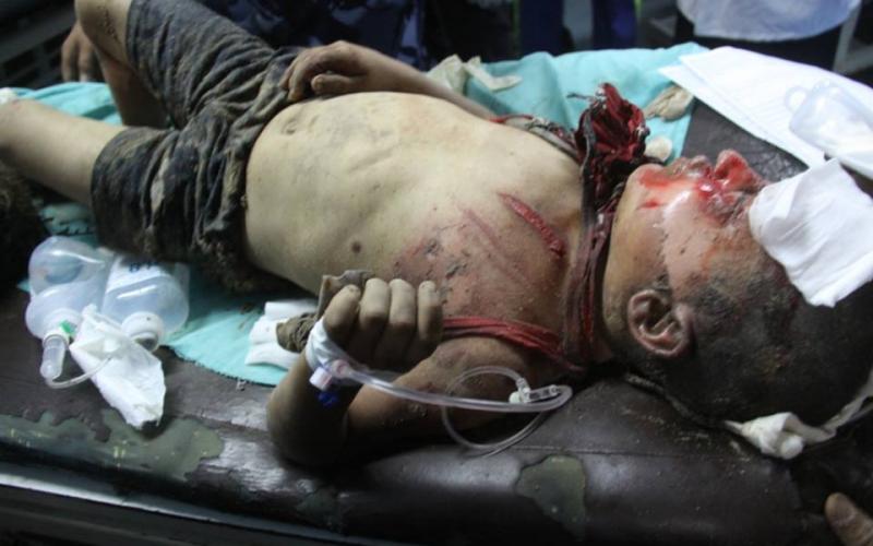 صور: وصول إصابات لمشفى الشفاء بغزة