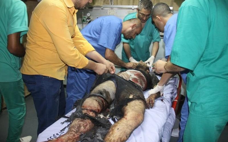 صور: شهداء وإصابات بقصف مواطنين بخانيونس