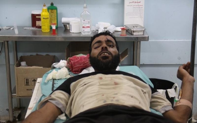 صور: شهداء وإصابات بقصف مواطنين بخانيونس