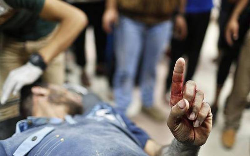 صور: لقطات متنوعة من العدوان على غزة