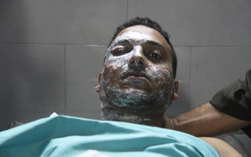 صور: مجزرة مروّعة في سوق الشجاعية