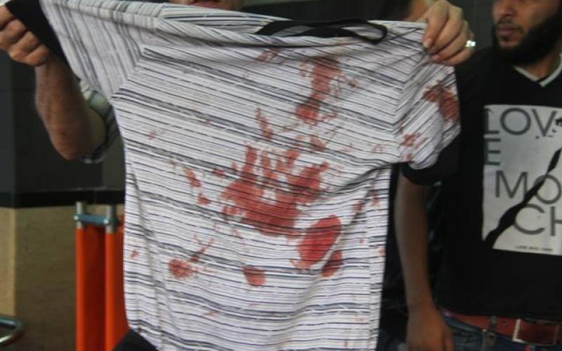 صور: وصول جرحى بقصف "باص" في غزة