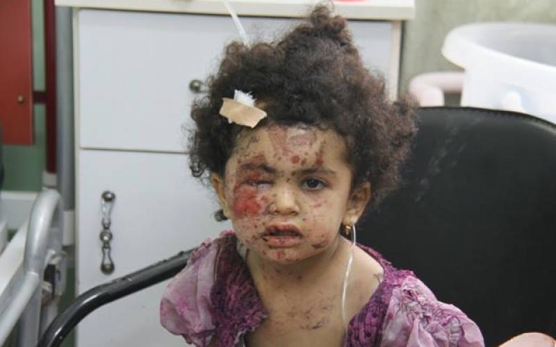 صور: شهداء رفح بثلاجات الخضار والبوظة