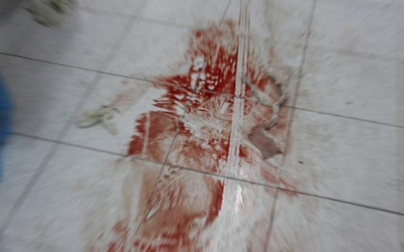 صور: شهداء رفح بثلاجات الخضار والبوظة