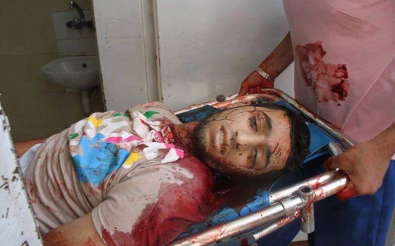 صور: جديدة لمجزرة رفح