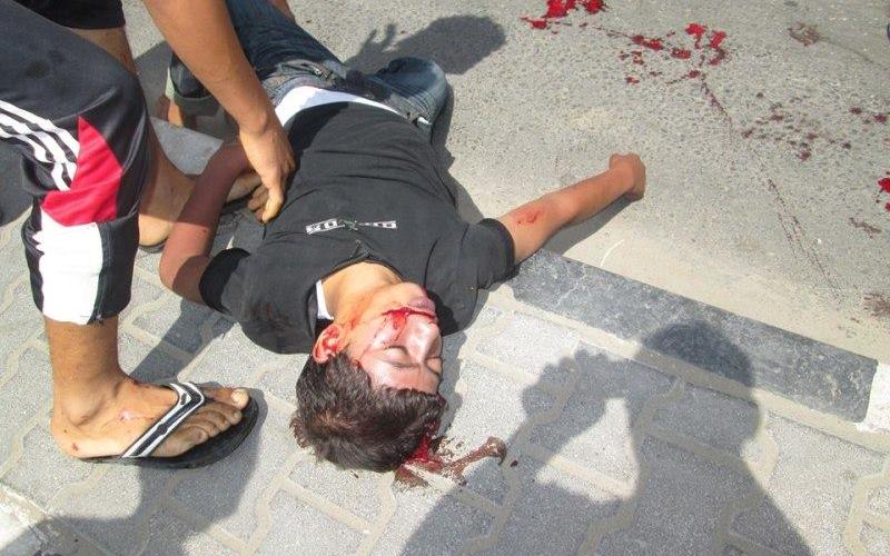 بالصور: مركز "إيواء رفح" أمان يتحول إلى ساحة دم