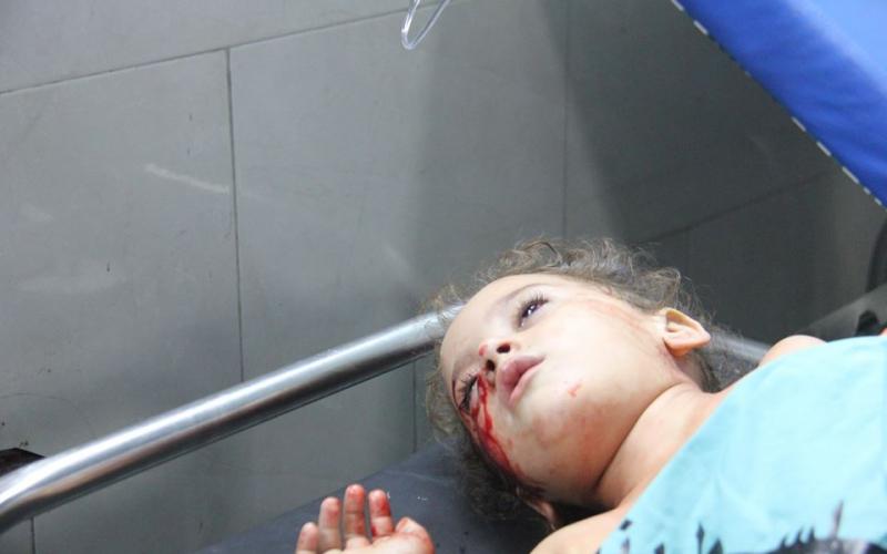 صور: أطفال جرحى بقصف شرق غزة