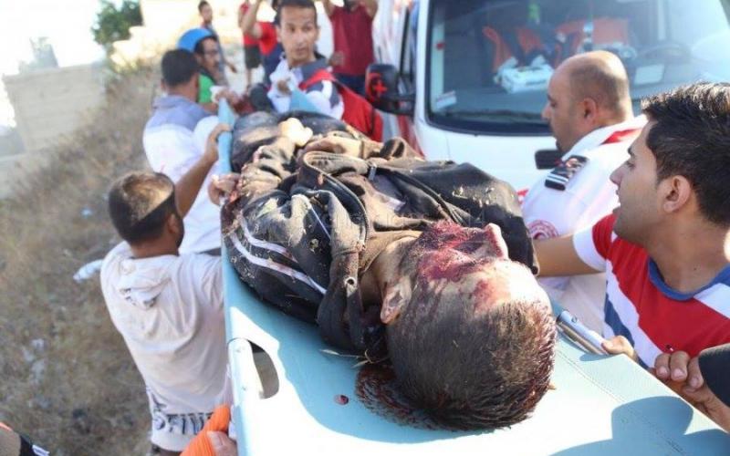 صور: الشهيد "الأقرع" بنابلس