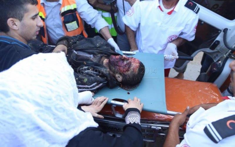 صور: الشهيد "الأقرع" بنابلس