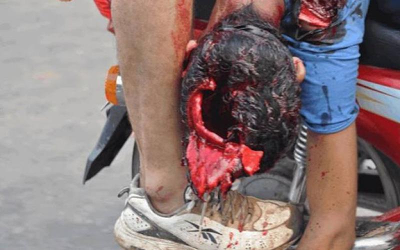 صور:في ذكرى رابعة.. الصورة وحدها تتحدث