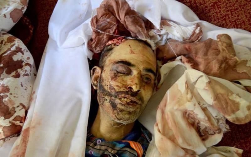 صور:في ذكرى رابعة.. الصورة وحدها تتحدث
