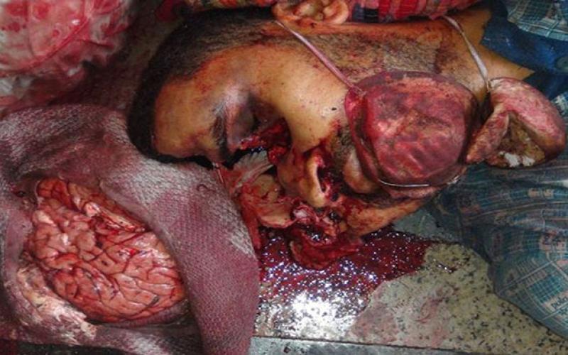 صور:في ذكرى رابعة.. الصورة وحدها تتحدث