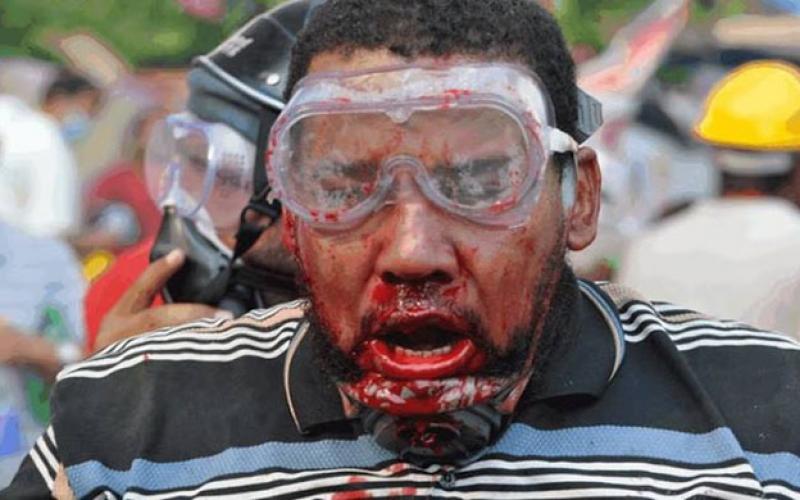 صور:في ذكرى رابعة.. الصورة وحدها تتحدث