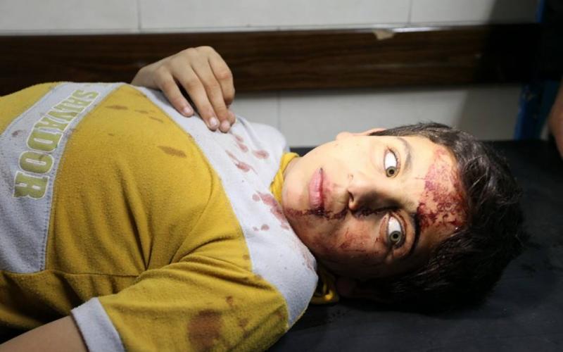 صور: 35 إصابة بقصف منزل "عقلين" بغزة