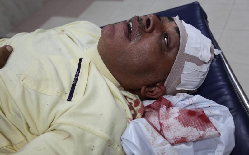 صور: 35 إصابة بقصف منزل "عقلين" بغزة