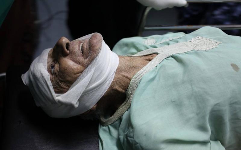 صور: 35 إصابة بقصف منزل "عقلين" بغزة