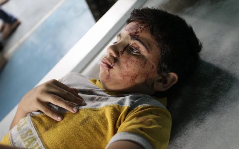 صور: 35 إصابة بقصف منزل "عقلين" بغزة