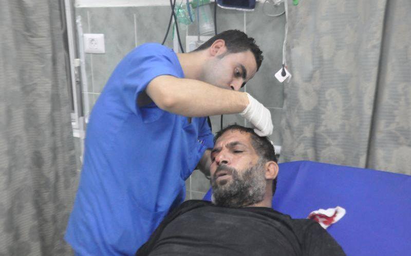صور: إصابات في قصف الاحتلال لرفح