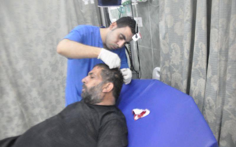 صور: إصابات في قصف الاحتلال لرفح