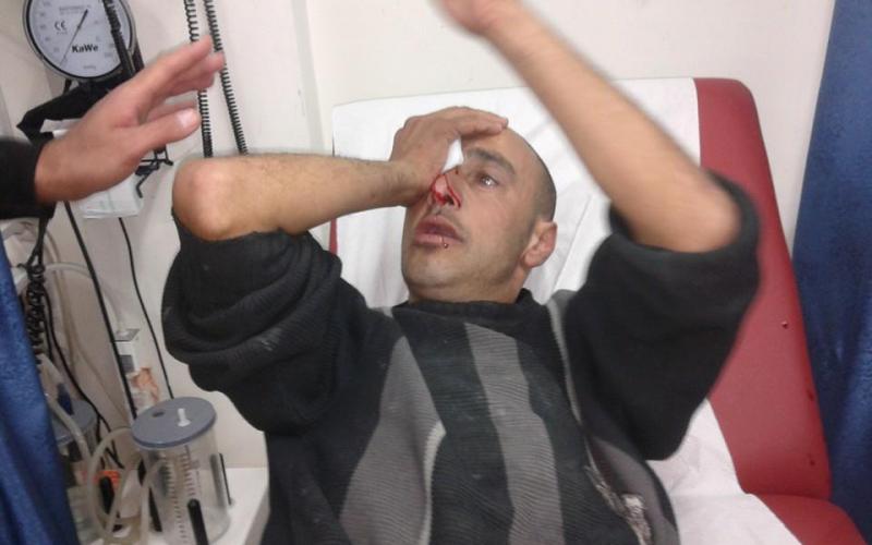 صور: إصابات في قمع الاحتلال لمسيرة نصرة الأقصى بالخليل