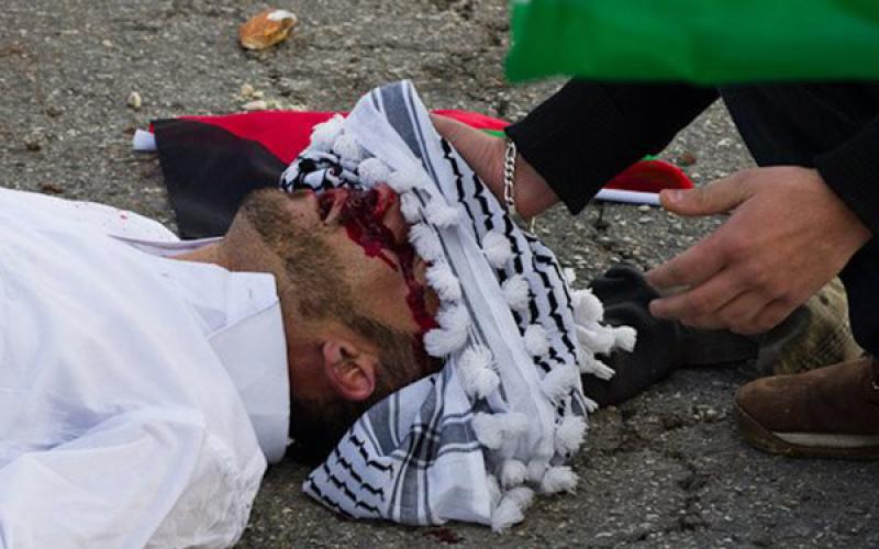لحظة إصابة متظاهر فلسطيني (صور)