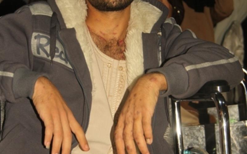 صور.. تكريم جرحى العدوان على غزة بالمتحف