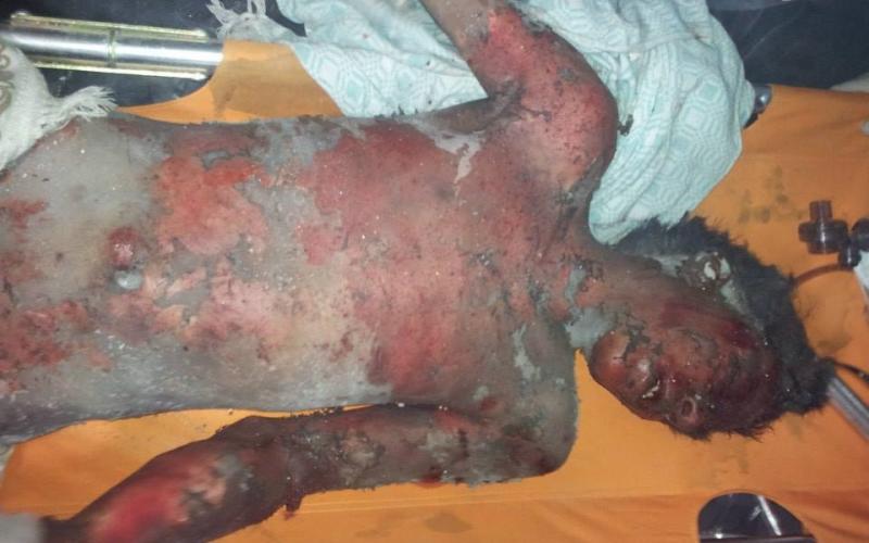 بالصور: مجزرة بحق لاجئينا بمخيم درعا