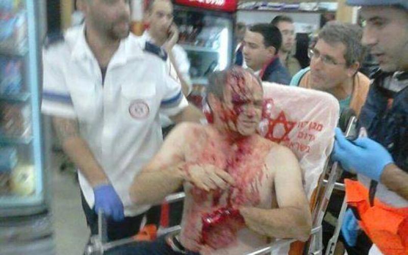 بالصور: أصيب المنفذ.. إصابة مستوطنين في عملية طعن قرب القدس