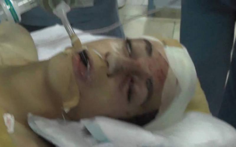 صور: المصابان "عوض" من داخل المشفى الأهلي