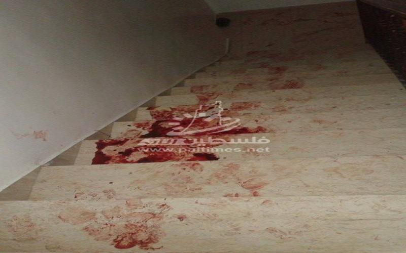 بالصور: استشهاد مسن برصاص مستعربين شمال الخليل