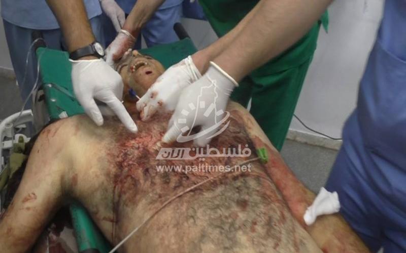 بالصور: استشهاد مسن برصاص مستعربين شمال الخليل