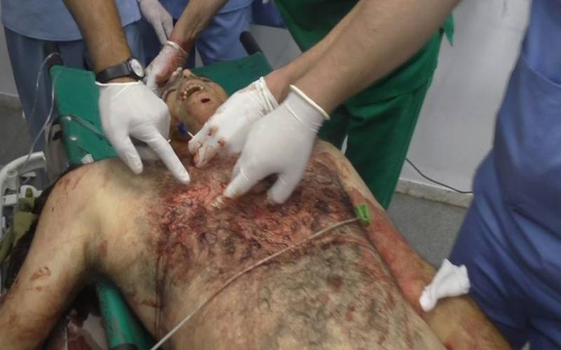بالصور: استشهاد مسن برصاص مستعربين شمال الخليل