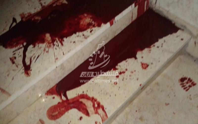 بالصور: استشهاد مسن برصاص مستعربين شمال الخليل