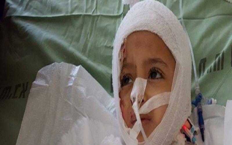 بالصور: تحسن حالة الطفل أحمد دوابشة في مشفى "تل هشومير"