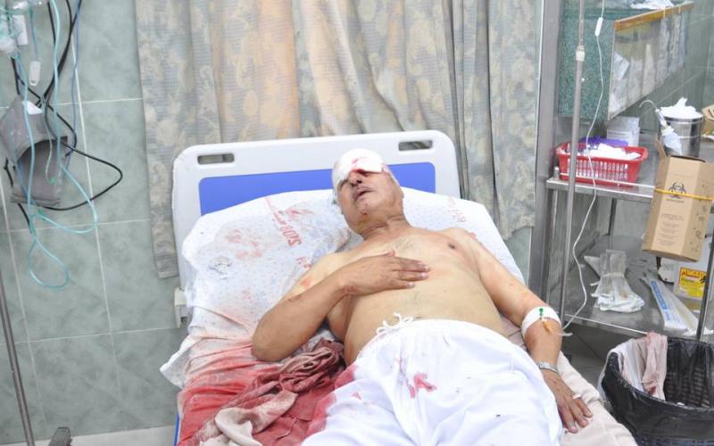 بالصور: عامٌ على مجزرة رفح الدامية