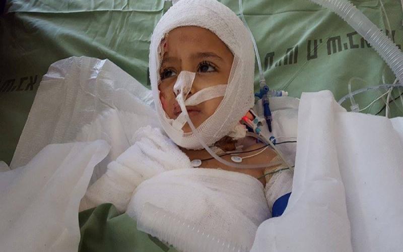 بالصور: تحسن حالة الطفل أحمد دوابشة في مشفى "تل هشومير"