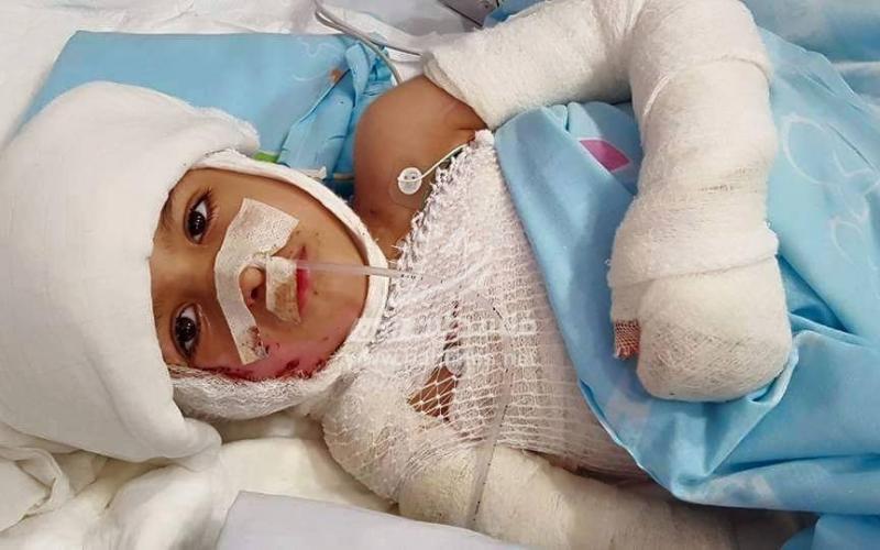 الناجي الوحيد من محرقة "دوابشة" يستشعر غياب والدته