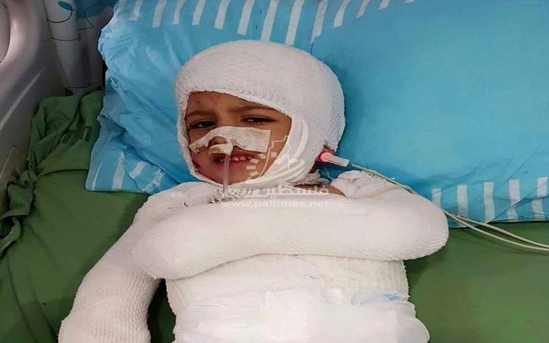 الناجي الوحيد من محرقة "دوابشة" يستشعر غياب والدته