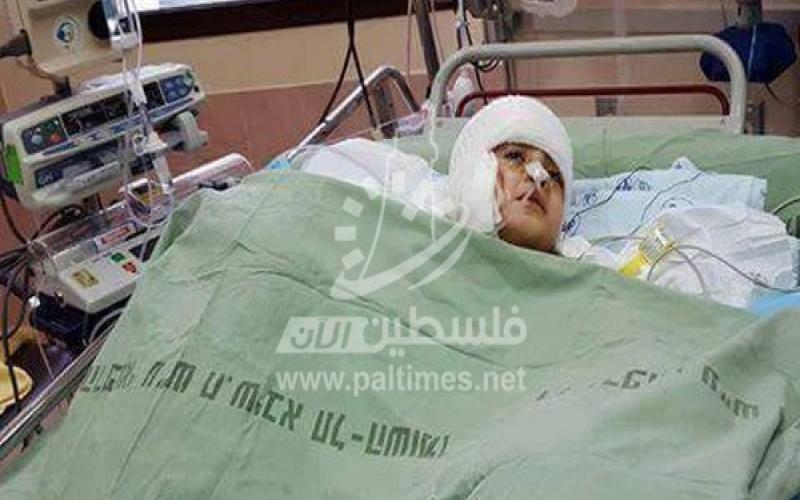 الناجي الوحيد من محرقة "دوابشة" يستشعر غياب والدته