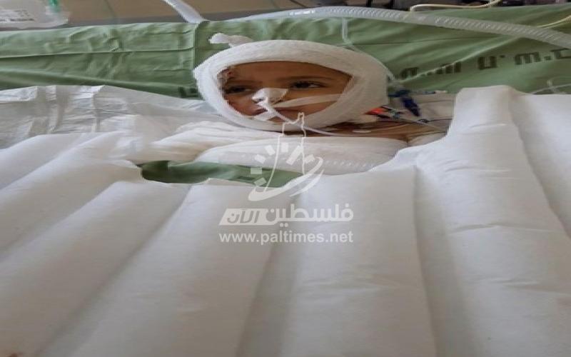 الناجي الوحيد من محرقة "دوابشة" يستشعر غياب والدته