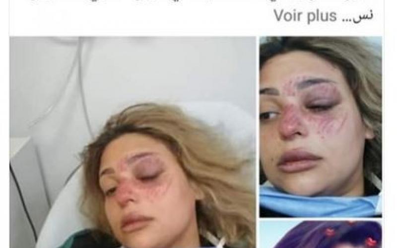 2.JPG
