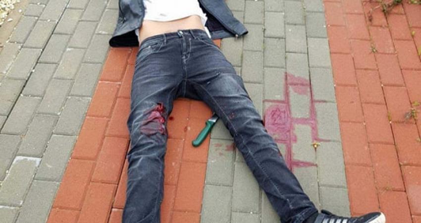 صورة الوضع الصحي للطفلين الجريحين محمد وزقزوق مستقر