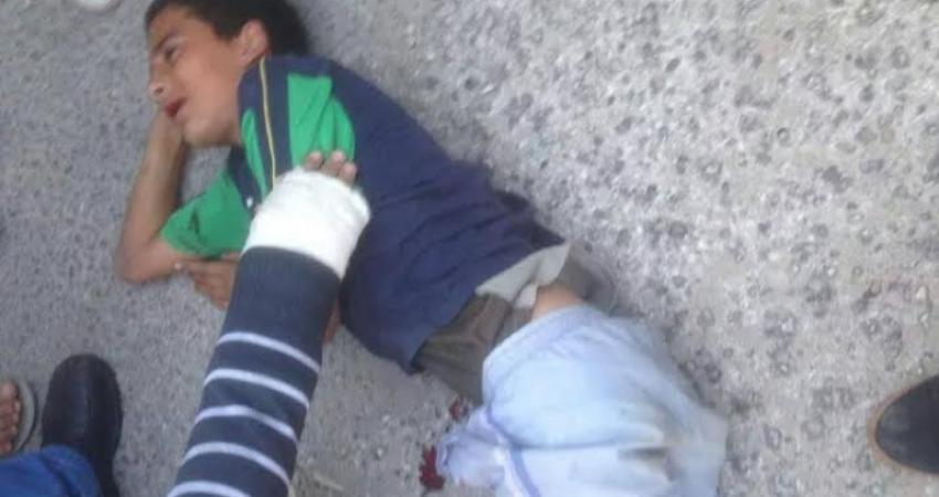 إصابة طفلين