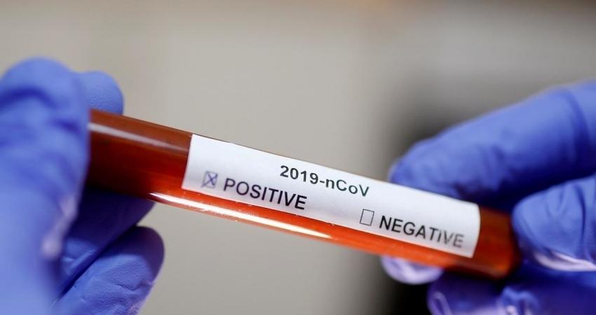 FILE PHOTO Test tube with Corona virus name label is seen in this illustration taken on January 29, 2020. REUTERS OK (1)