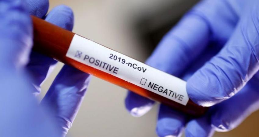 CoronaVirus-780x465