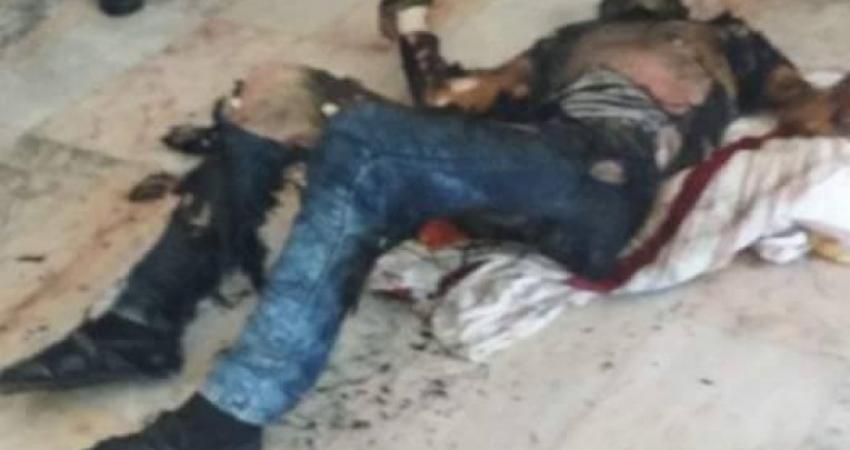 شاب يحاول الانتحار بإشعال النار في جسده غرب غزة