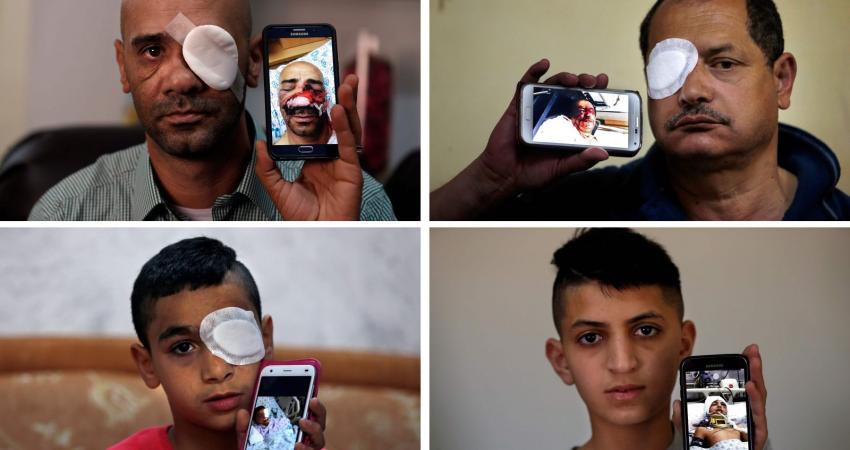 القدس إصابات 